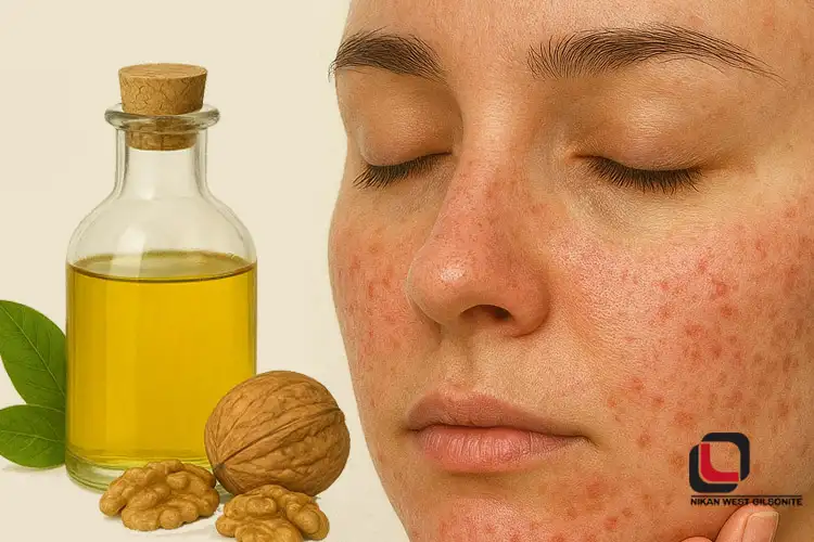 فواید روغن گردو برای لک صورت (قیر غرب نیکان)
